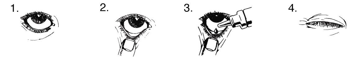 Lumigan-all 4 pictures