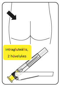 C:\Users\dcseresnye\Desktop\rispi-inj\11.png