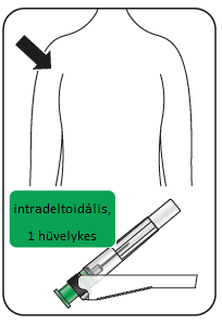 C:\Users\dcseresnye\Desktop\rispi-inj\10.png